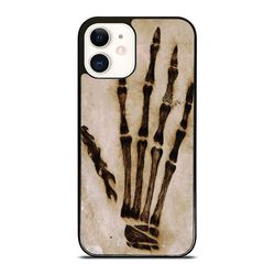 vintage bone arm iphone case - stylish & durable phone cover for iphone