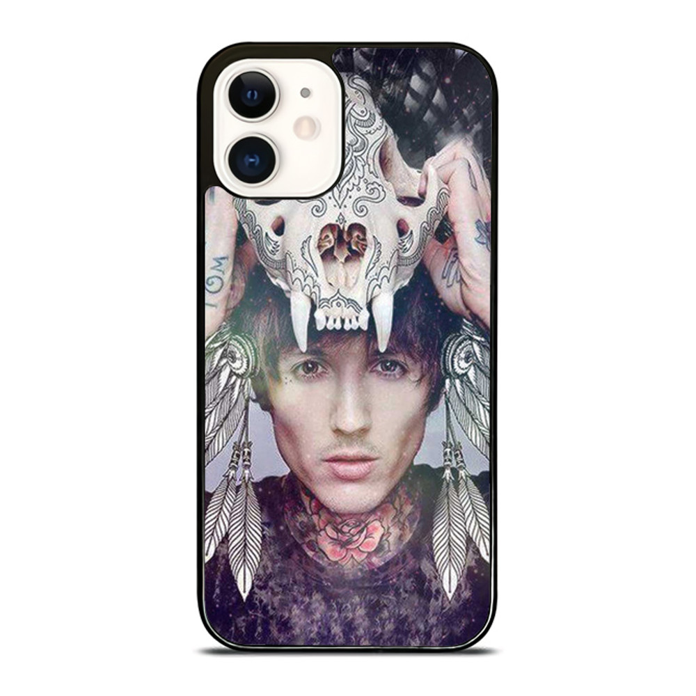 Oliver Sykes Skull Custom IPhone Case  Personalize Your Style Today 0