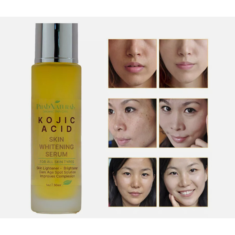 Kojic Acid Skin Whitening Lightening Brightening Serum Bleaching Spot Fade Cream