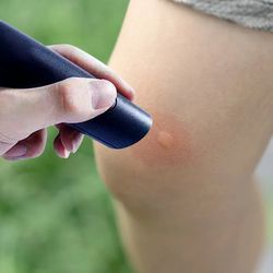 electronic mosquito bite pen relief burning pain & swelling relieve stings pen mosquito against portable tool
