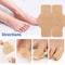 FungiShield Waterproof Nail Fungus Treatment Patch Ingrown Toenail Correction Stickers 3