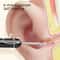 ClearView HD Ear Cleaner Camera With LED Lights For Safe Ear Wax Removal 3