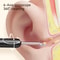 ClearView HD Ear Cleaner Camera With LED Lights For Safe Ear Wax Removal 3