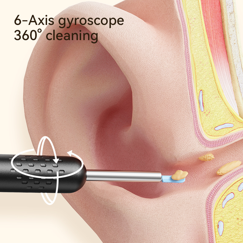 ClearView HD Ear Cleaner Camera With LED Lights For Safe Ear Wax Removal 3