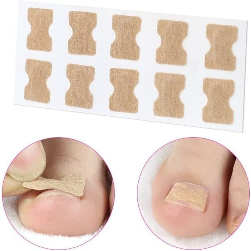 Precision Ingrown Toenail Corrector Clip Kit For Gentle Nail Straightening And Foot Care 2