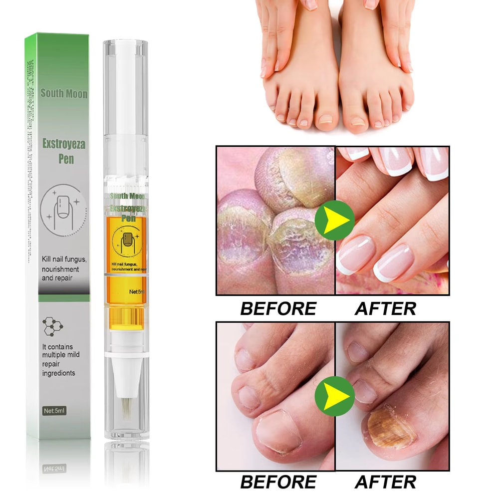 South Moon Nail Fungus Repair Pen For Toenail Care And Nail Brightening 4