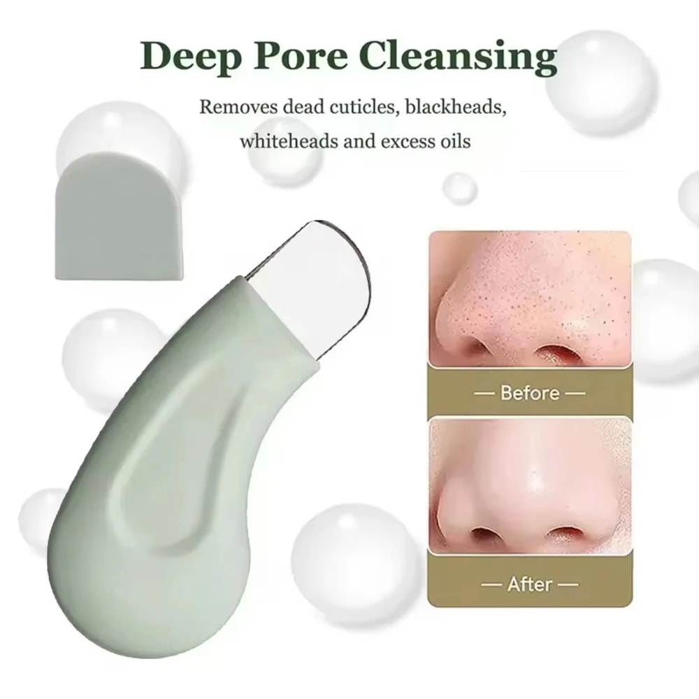 PoreClear Blackhead Remover Tool For Deep Facial Pore Cleansing 2