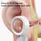 SmartView HD Ear Wax Removal Camera with Visual Otoscope & Rotating Lens