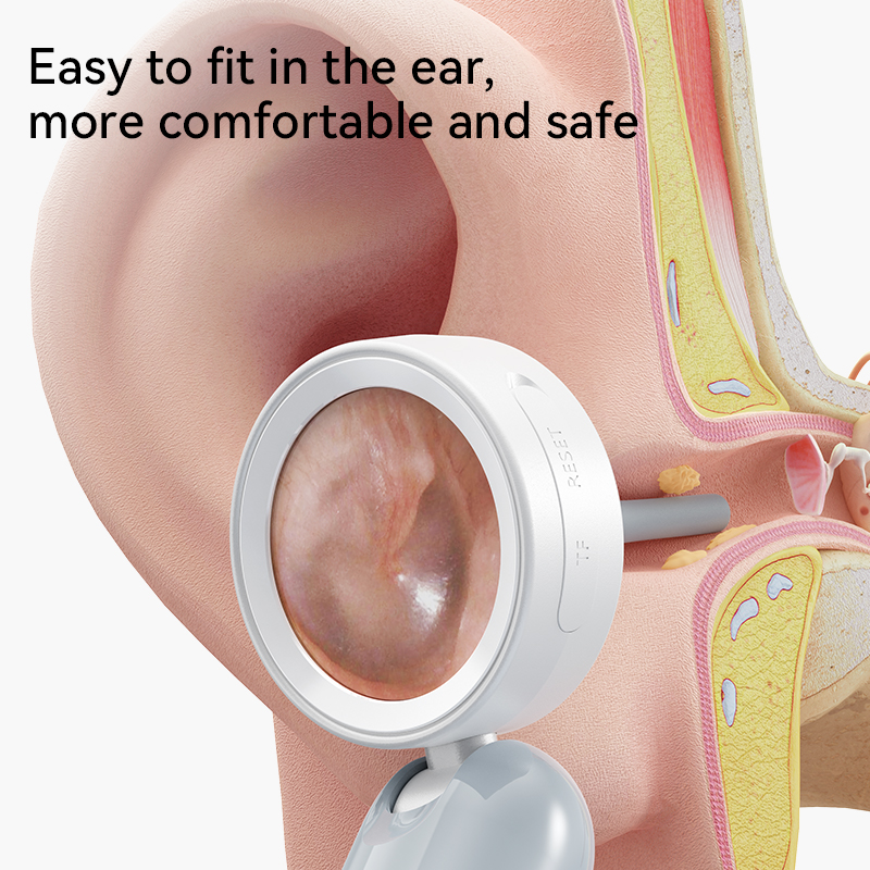 SmartView HD Ear Wax Removal Camera with Visual Otoscope & Rotating Lens