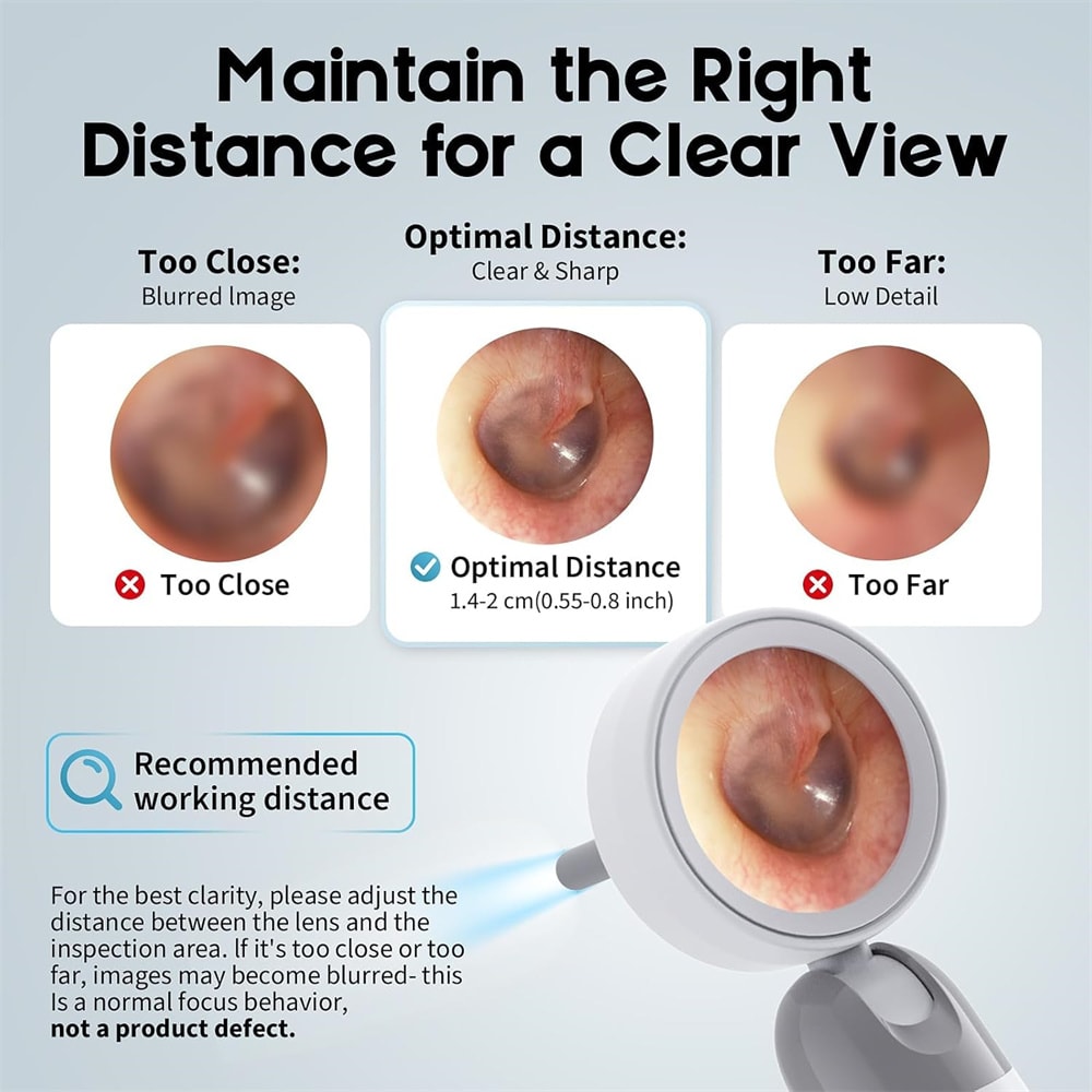 SmartView HD Ear Wax Removal Camera with Visual Otoscope & Rotating Lens