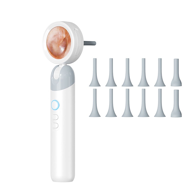 SmartView HD Ear Wax Removal Camera with Visual Otoscope & Rotating Lens