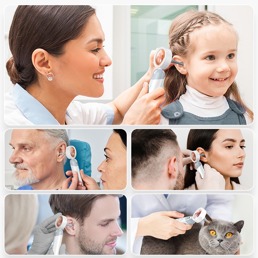 SmartView HD Ear Wax Removal Camera with Visual Otoscope & Rotating Lens