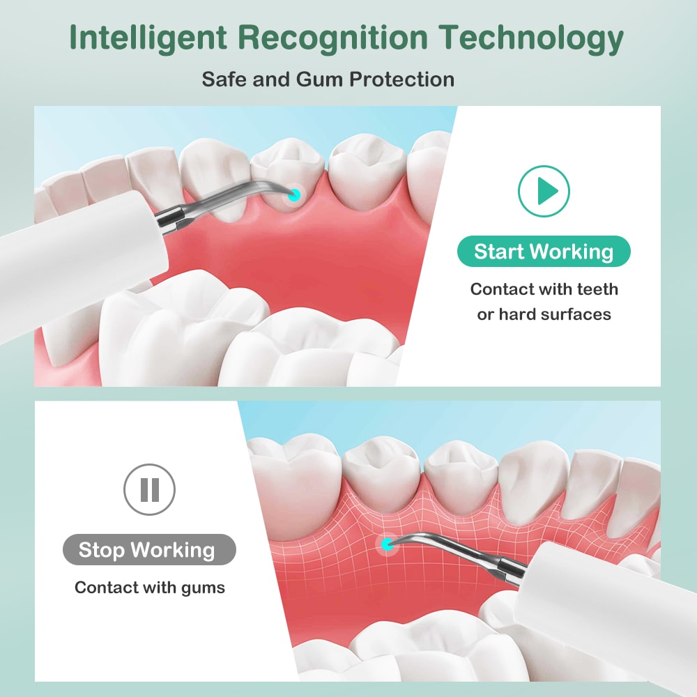 Ultrasonic Dental Plaque Remover With LED Light Cleaning Modes 1
