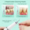 Ultrasonic Dental Plaque Remover With LED Light Cleaning Modes 5