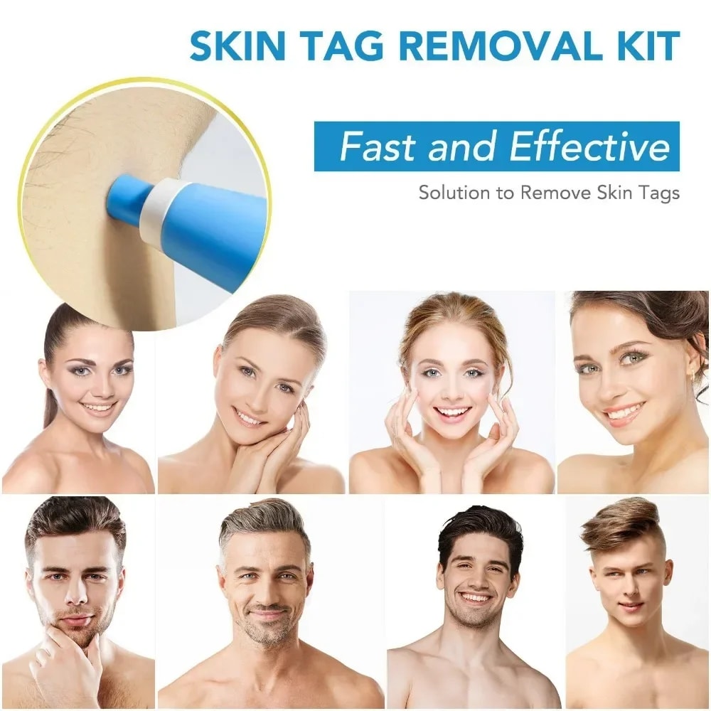 Painless Skin Tag Remover Wart Removal Kit For Face And Body Care 2