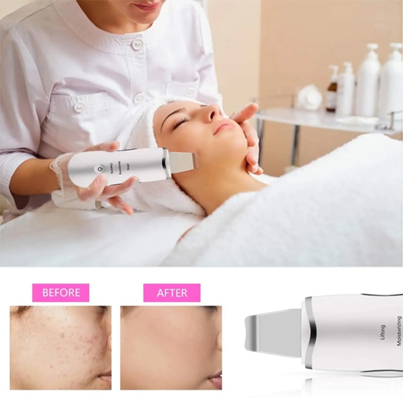 Professional Ultrasonic Facial Skin Scrubber Deep Pore Cleanser Blackhead Remover Device 3