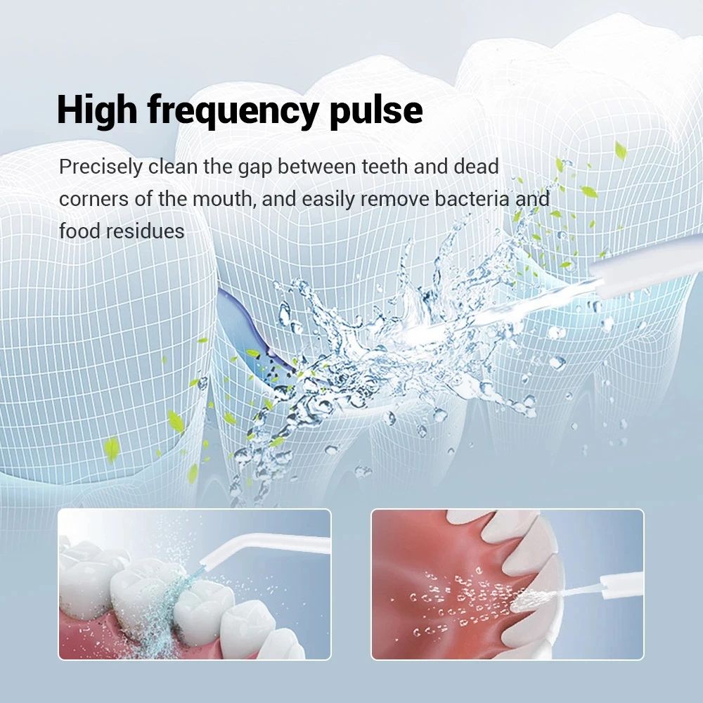 YOUPIN Water Flosser USB Rechargeable Electric Oral Irrigator For Dental Whitening Jet Tooth Scaler 1