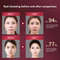 Facial Slimming Vibration Massager With LED Photon Therapy Heated V Face Lifting Device For Double 5
