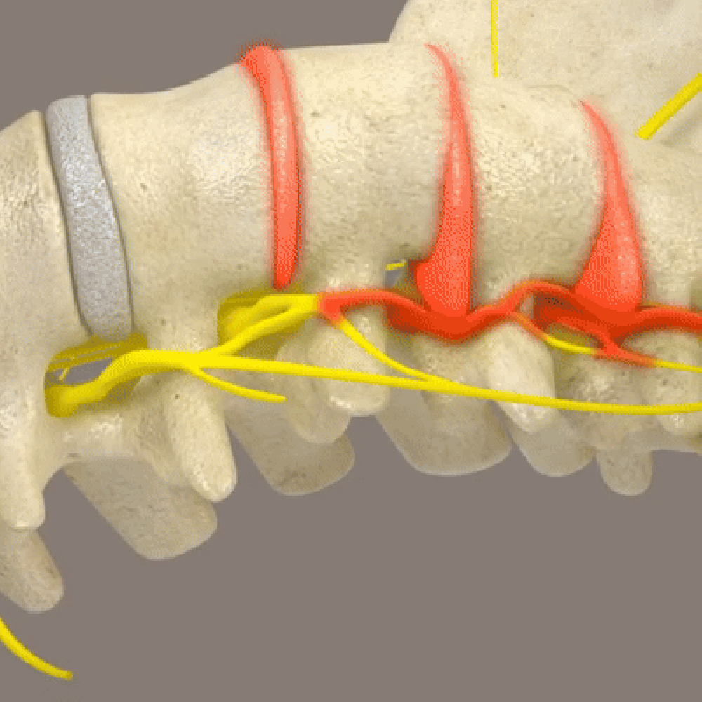 Man relaxing on ergonomic posture corrector with spinal decompression function