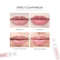 Derma Roller Titanium Needle Roller For Beard  Lip Beard Growth Roller With Serum Applicator Beard  2