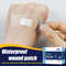 PU Transparent Waterproof Band Aid Adhesive Medical Strips Invisible Wound Plasters For Sports Bat 1