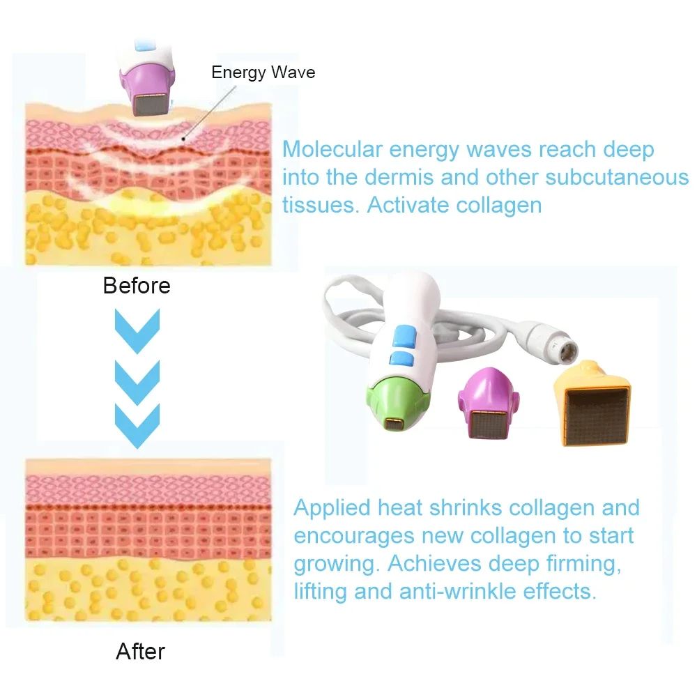 Replacement Tips For Skin Rejuvenation Machine Body Face Eye Cartridges Skin Care Tools Beauty Inst 3