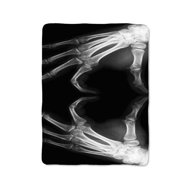 X Ray Love Blanket 0