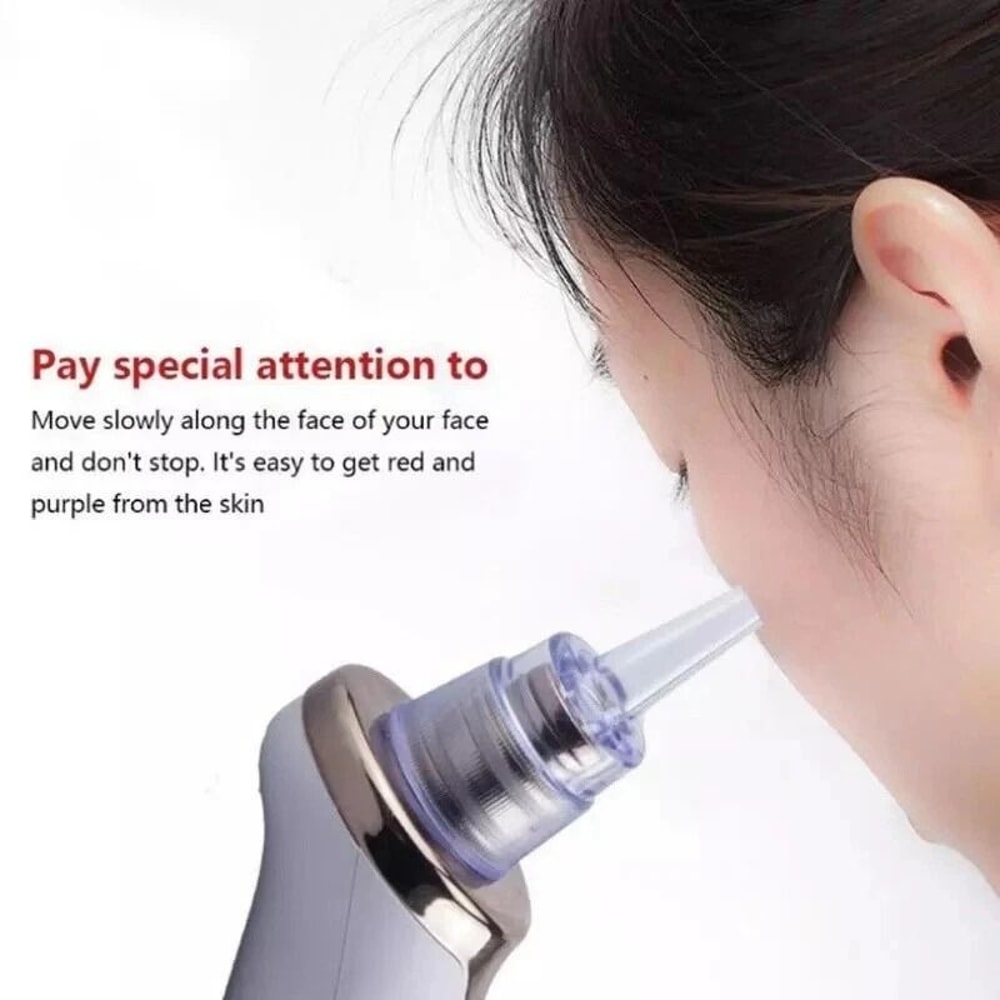 Diamond Dermabrasion Face Cleaner Electric Blackhead Remover Pore Vacuum Suction 3