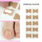 Toenail Corrector Sticker Ingrown Toe Foot Nail Fix Pedicure Tool For Quick Relief And Healing 4