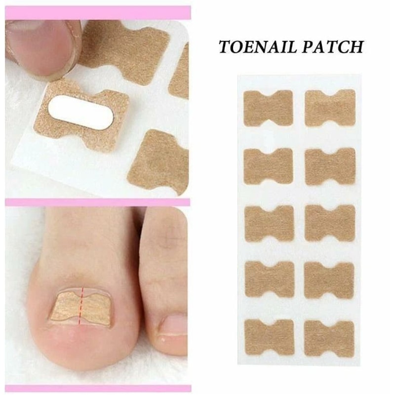 Toenail Corrector Sticker Ingrown Toe Foot Nail Fix Pedicure Tool For Quick Relief And Healing 4