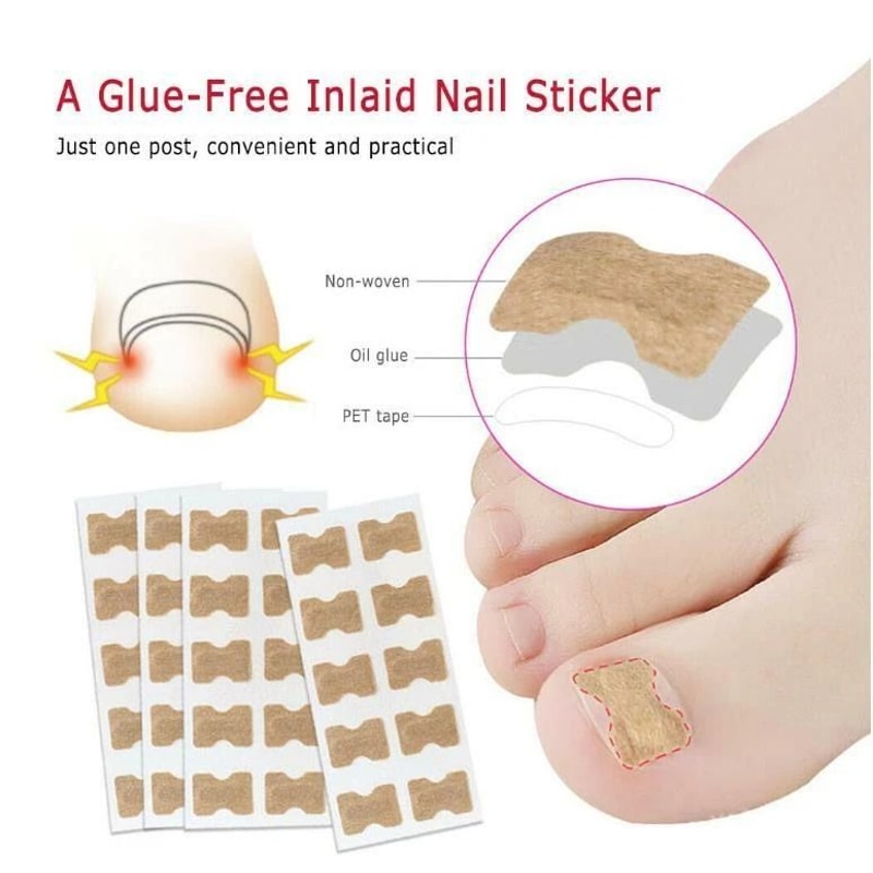 Toenail Corrector Sticker Ingrown Toe Foot Nail Fix Pedicure Tool For Quick Relief And Healing 5