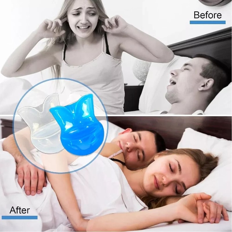 Snore Stopper Anti Snoring Sleep Aid Device Silicone Tongue Mouthpiece With Case 2