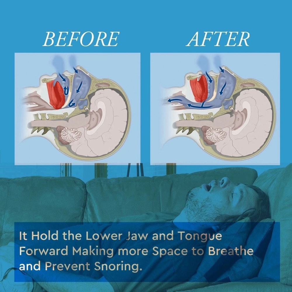 Bruxism Anti Snore Tray Stop Snoring Mouthpiece Sleep Apnea Guard 3