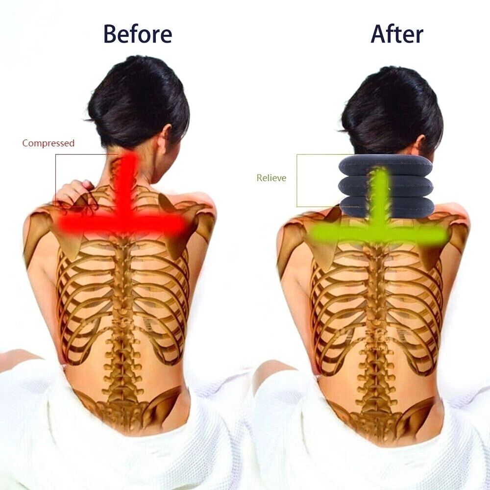 Pain Relief Stretcher Therapy Cervical Neck Traction Device Support Collar 1