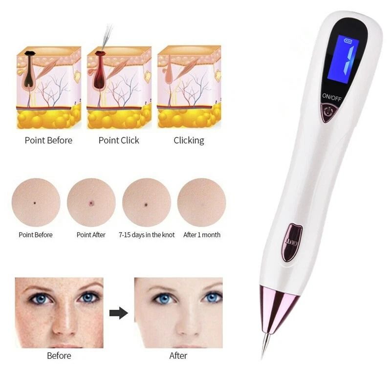 Plasma Pen AntiAging Treatment Tattoo Wart Remover Skin Tag Solution 8