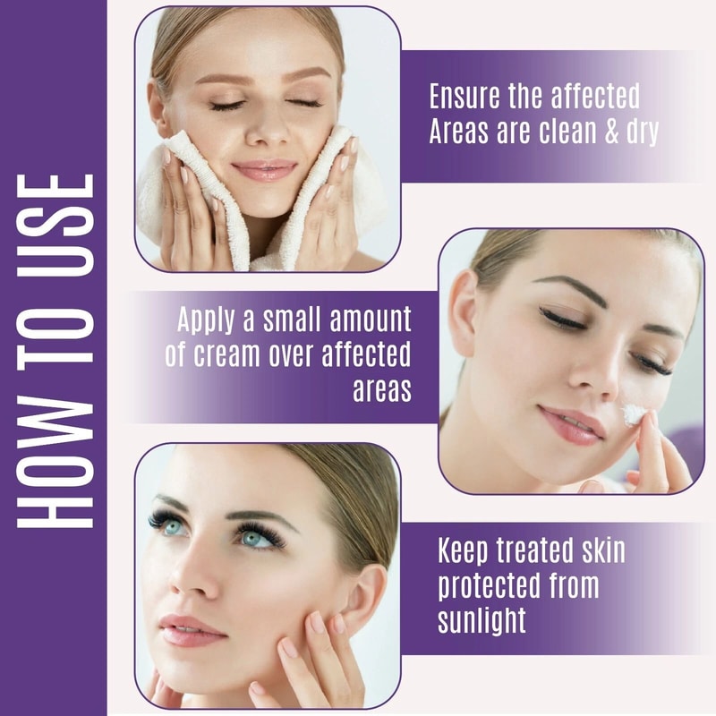 Organic Dark Spot Corrector For Face Body Age Sunspot Remover 2