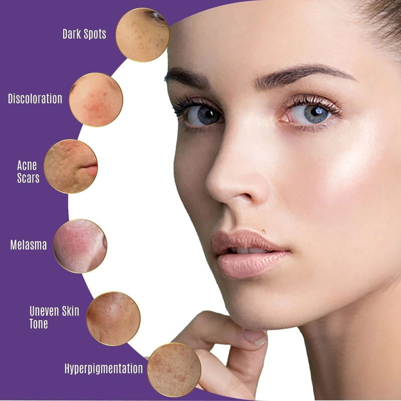 Organic Dark Spot Corrector For Face Body Age Sunspot Remover 7