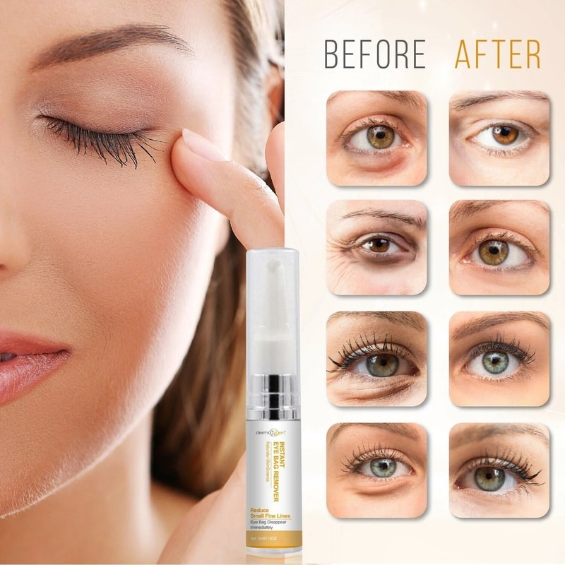 Instant Eyebag Remover For Dark Circles Puffiness Fine Lines 10