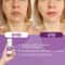 Instant Face Lift Cream Anti Aging Treatment For Sagging Skin Puffiness Wrinkles And Fine Lines 7