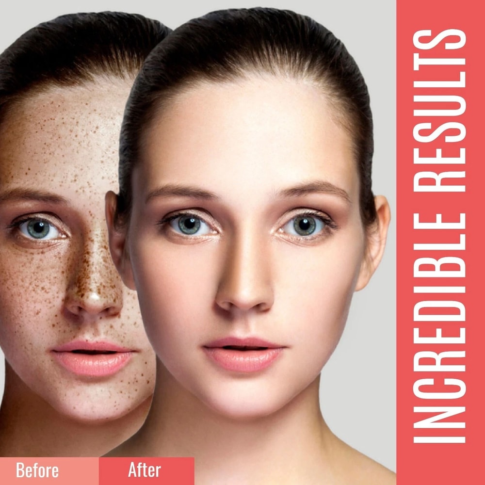 Organic Dark Spot Corrector Sunspot Remover For Face Body Brightening Skin Serum 5