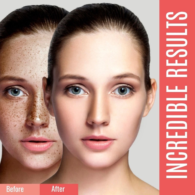 Organic Dark Spot Corrector Sunspot Remover For Face Body Brightening Skin Serum 5