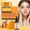 Turmeric Face Serum For Acne Dark Spots And Pigmentation Blemish Corrector Skin Brightener 2