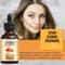 Turmeric Face Serum For Acne Dark Spots And Pigmentation Blemish Corrector Skin Brightener 9