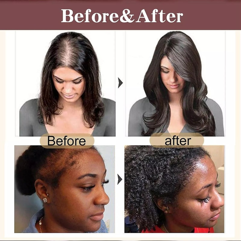 Organic Batana Oil For Hair Growth Skin Moisture Pure Batana Oil Treatment 1