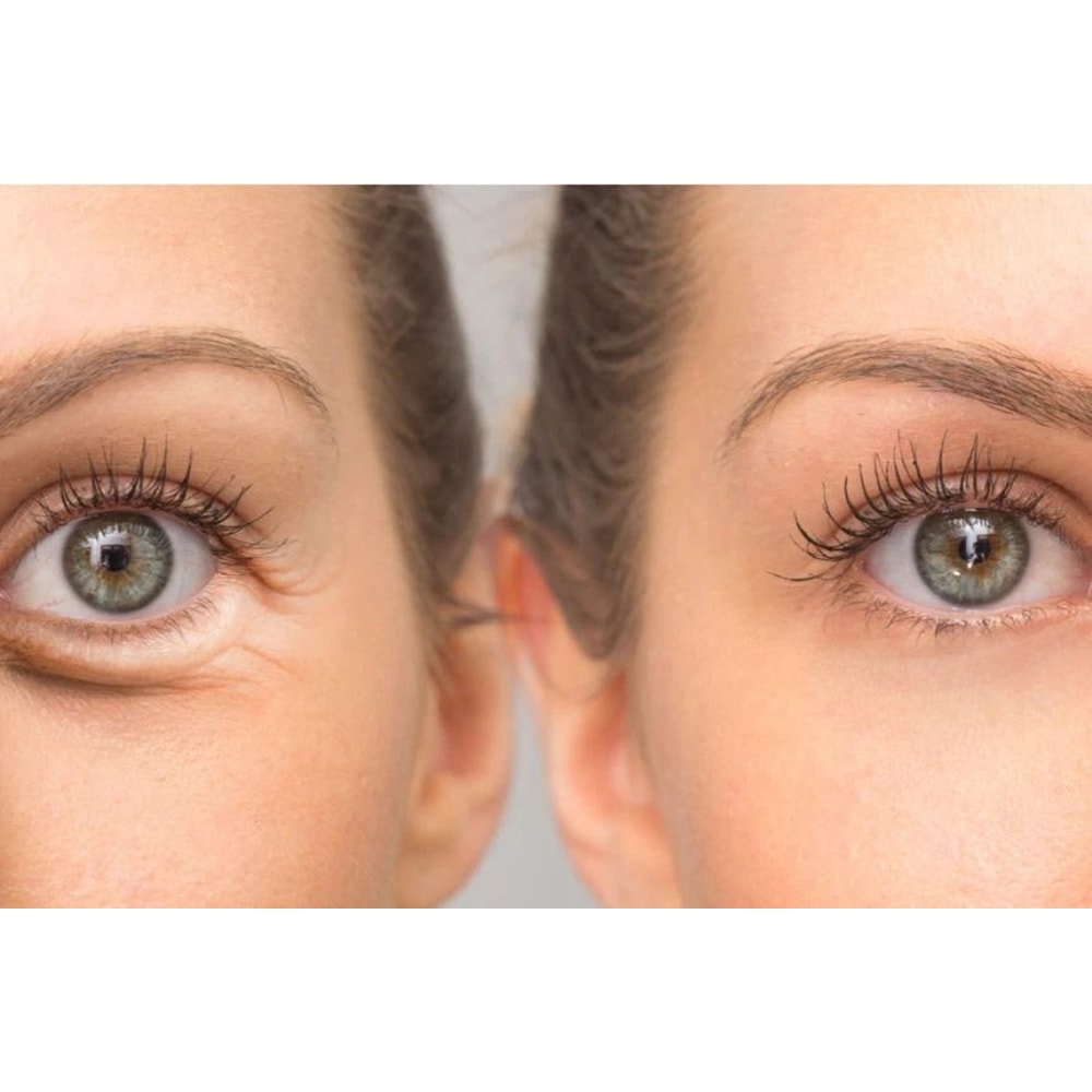 Vitamin C Eye Lift Serum For Dark Circles And Puffiness With Hyaluronic Acid 3