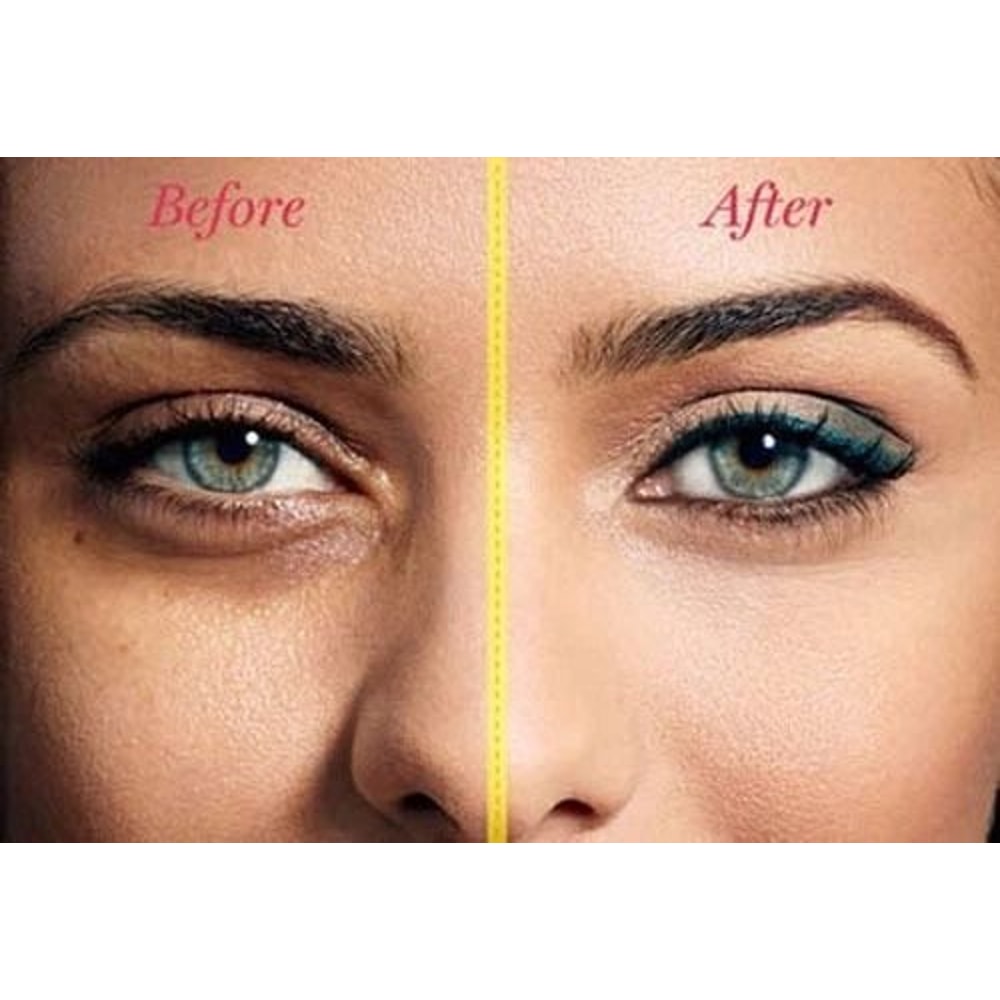 Hyaluronic Acid Under Eye Cream For Dark Circles Puffiness And Fine Lines 4