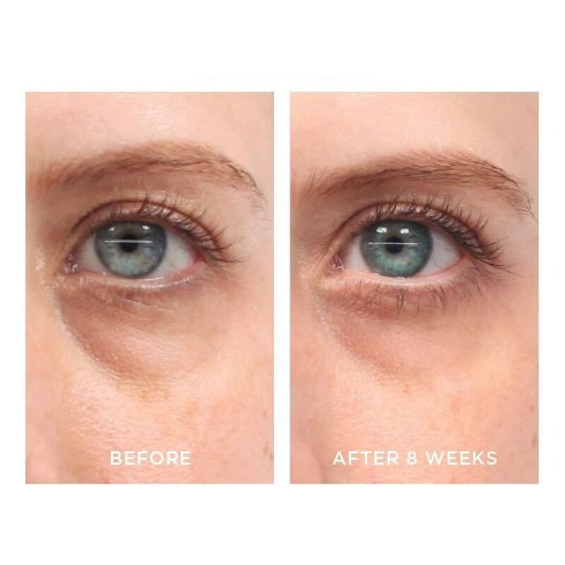 Retinol Serum Vitamin A Anti Aging Facial Serum For Wrinkles And Smoother Looking Skin 1