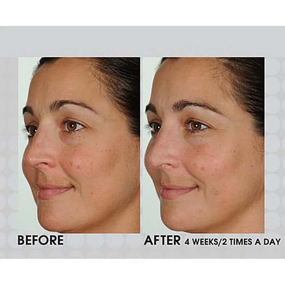 Retinol Serum Vitamin A Anti Aging Facial Serum For Wrinkles And Smoother Looking Skin 2