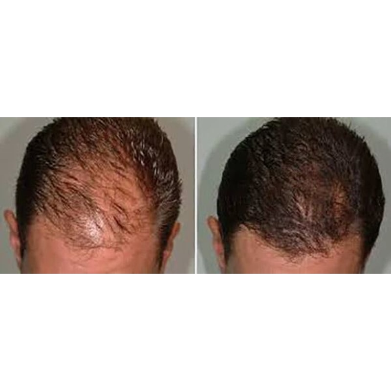Best Fast Hair Loss Regrowth Shampoo With Organic Oils For Men Women 2