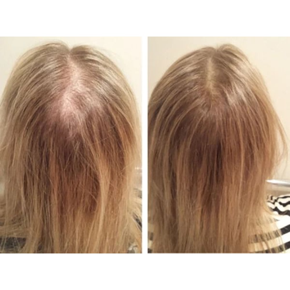 Best Fast Hair Loss Regrowth Shampoo With Organic Oils For Men Women 4